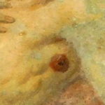 This is an enlargement of the armpit of the plague victim.